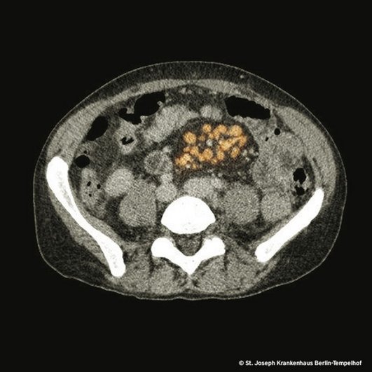 Die Diagnose hinter der Diagnose