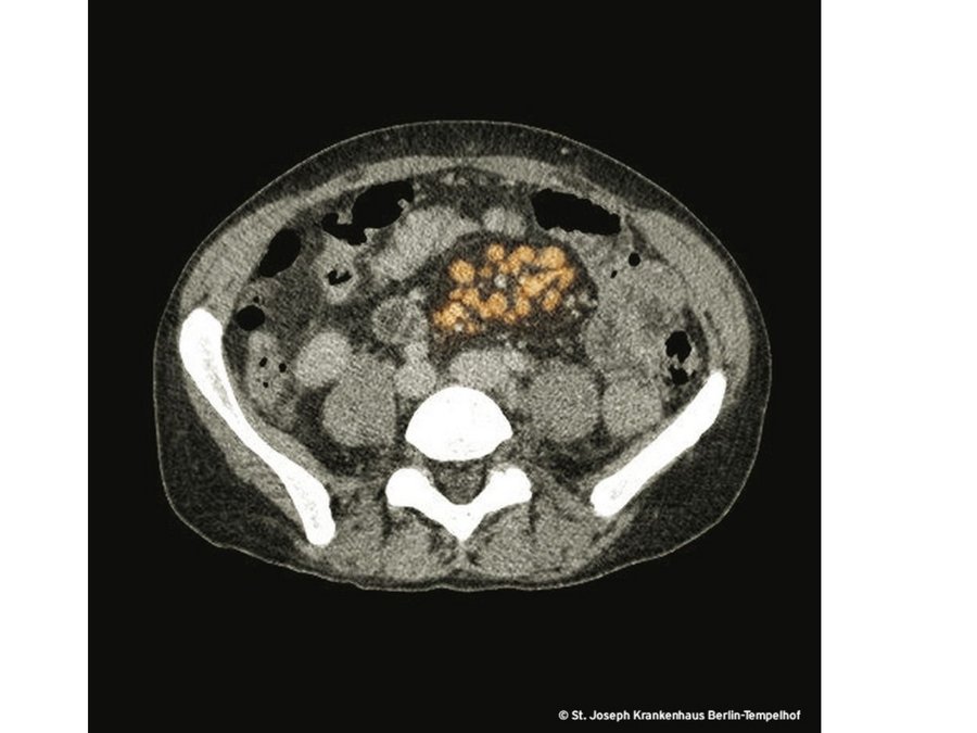 Die Diagnose hinter der Diagnose